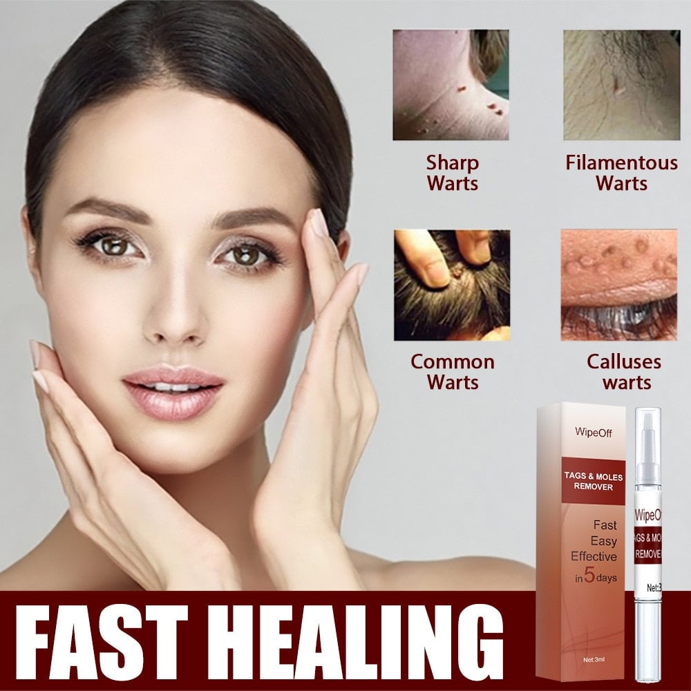 Wipeoff Tags & Moles Remover