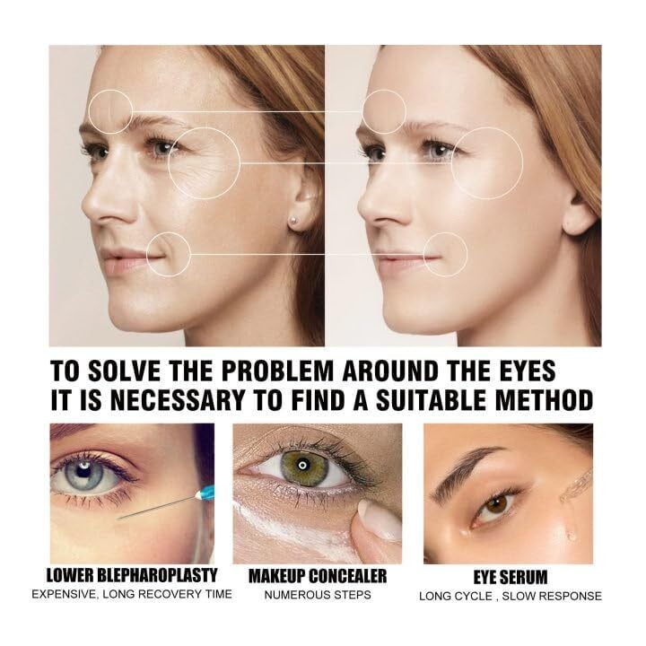 Berbax Firm Eye Tightener