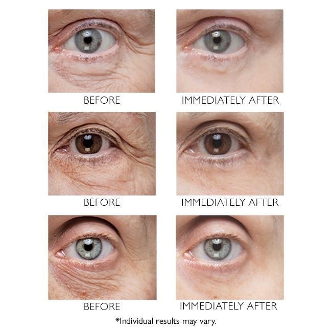 Berbax Firm Eye Tightener