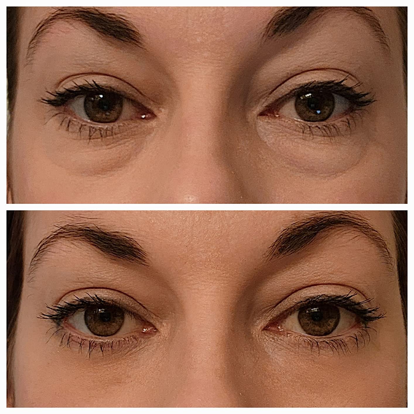 Berbax Firm Eye Tightener