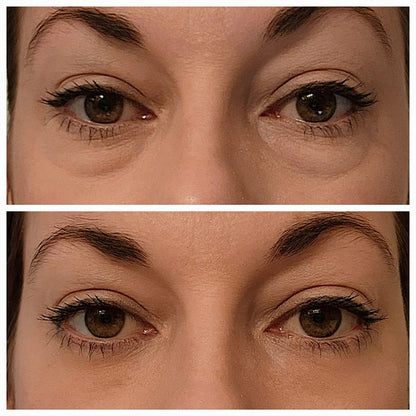 Berbax Firm Eye Tightener