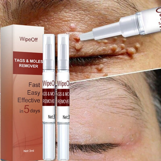 Wipeoff Tags & Moles Remover