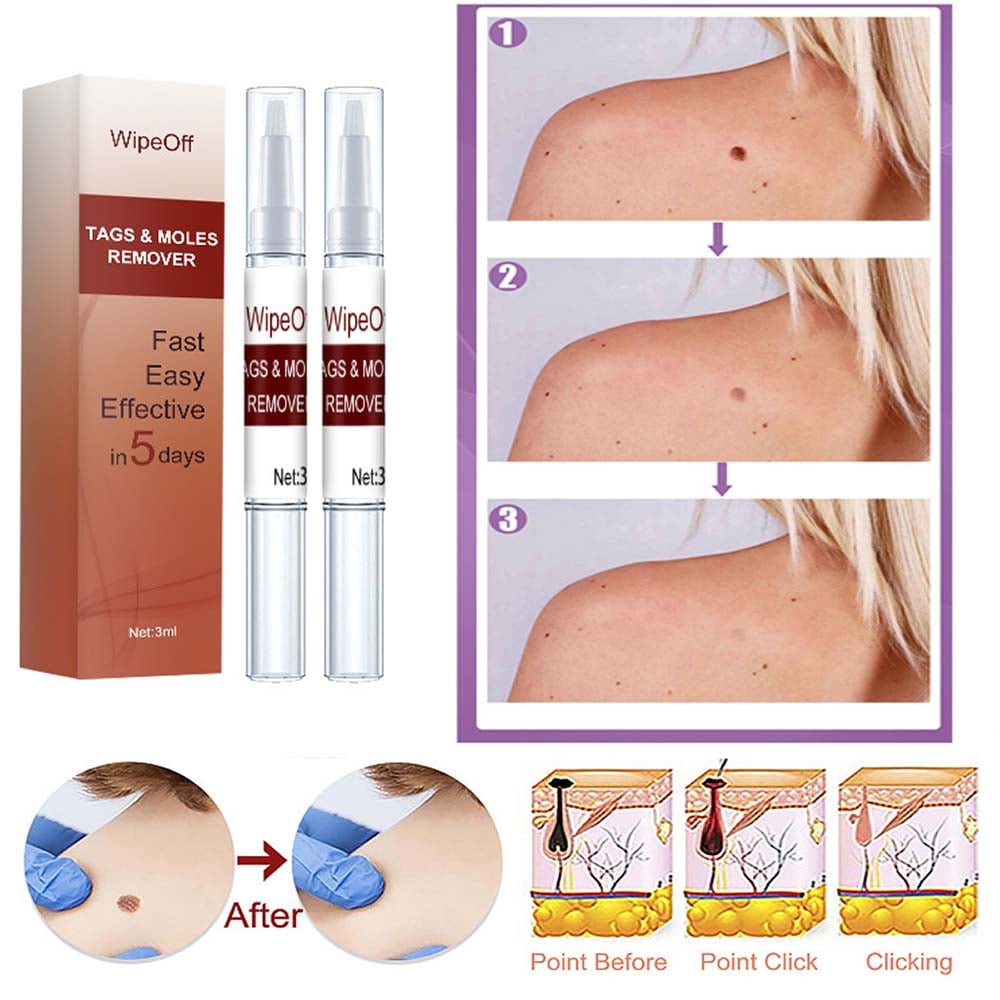 Wipeoff Tags & Moles Remover