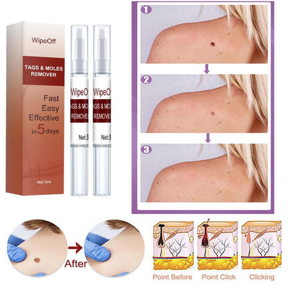 Wipeoff Tags & Moles Remover
