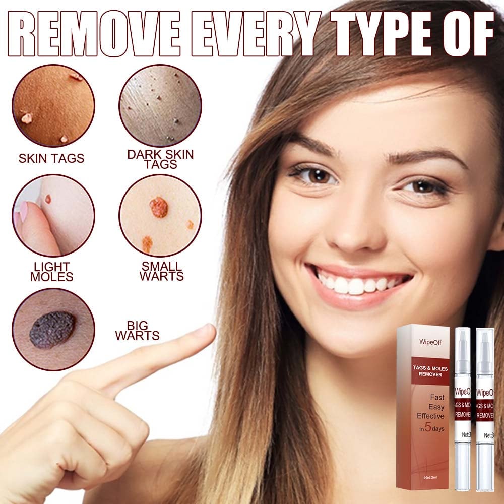 Wipeoff Tags & Moles Remover