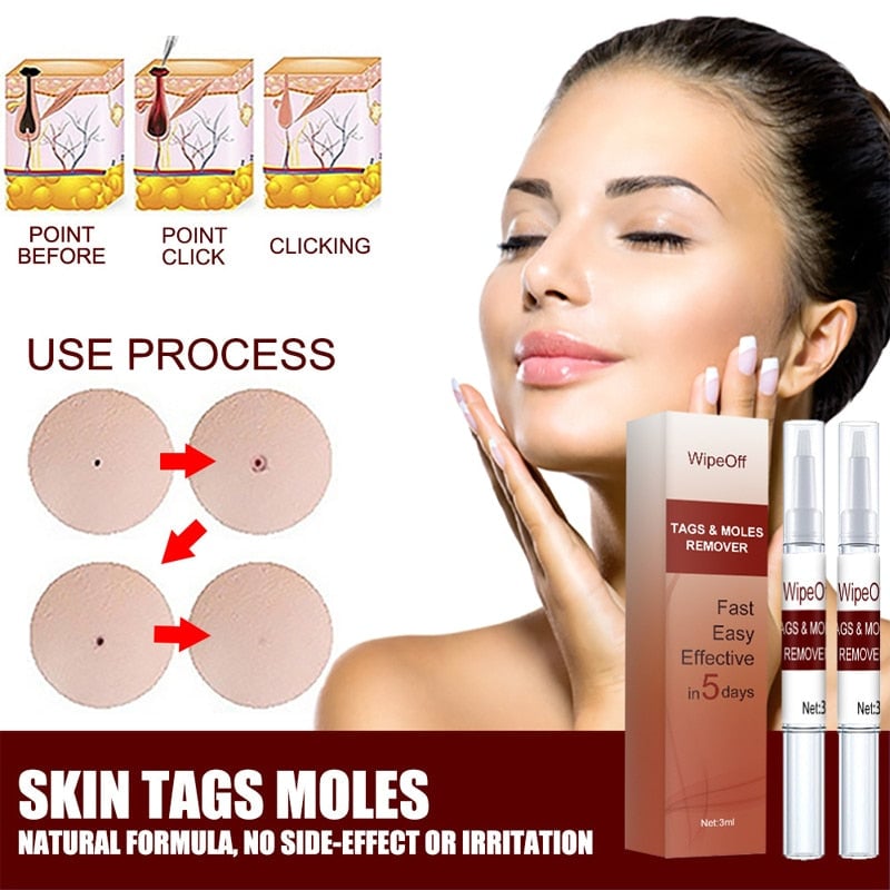 Wipeoff Tags & Moles Remover